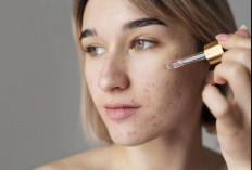 7 Rekomendasi Skincare untuk Menghilangkan Flek Hitam di Wajah, Awasn Hindari Juga Penyebabnya 
