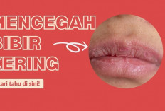 In Dia Cara Mencegah Bibir Kering yang Perlu Kamu Lakukan