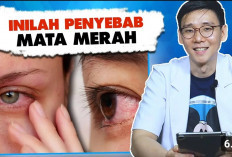 Inilah 7 Penyebab Mata Merah pada Anak, Yuk Cari Tahu Biar Cepat Teratasi