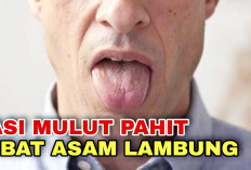 Simak Beberapa Cara Mengatasi Mulut Kering Akibat Asam Lambung yang Perlu Kamu Ketahui