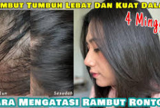 Cara Mengatasi Kebotakan Akibat Rambut Rontok Menggunakan Bahan-bahan alami 