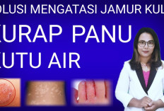 Ternyata Ini Penyebab Jamur Pada Kulit dan Cara Memeranginya yang Wajib Kamu Tahu