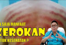 5 Manfaat Kerokan untuk Kesehatan dan Efek Sampingnya