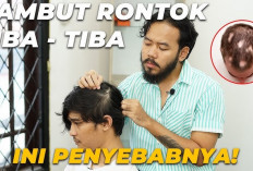 Simak 5 Penyebab Kerontokan Rambut yang Mungkin Kamu Alami