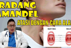 7 Obat Alami Amandel yang Dapat Kamu Coba di Rumah, Cukup Gunakan Bawang Putih