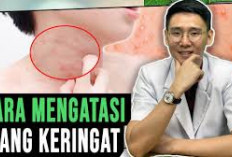 Inilah Cara Mengatasi Alergi Keringat, Penyebab dan Gejalanya