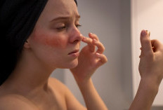 5 Ciri Skincare Tidak Cocok di Kulit Wajah
